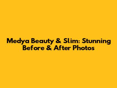 Medya Beauty & Slim: Stunning Before & After Photos