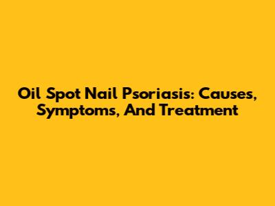 Oil Spot Nail Psoriasis: Causes, Symptoms, And Treatment
