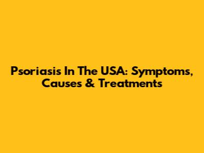Psoriasis In The USA: Symptoms, Causes & Treatments